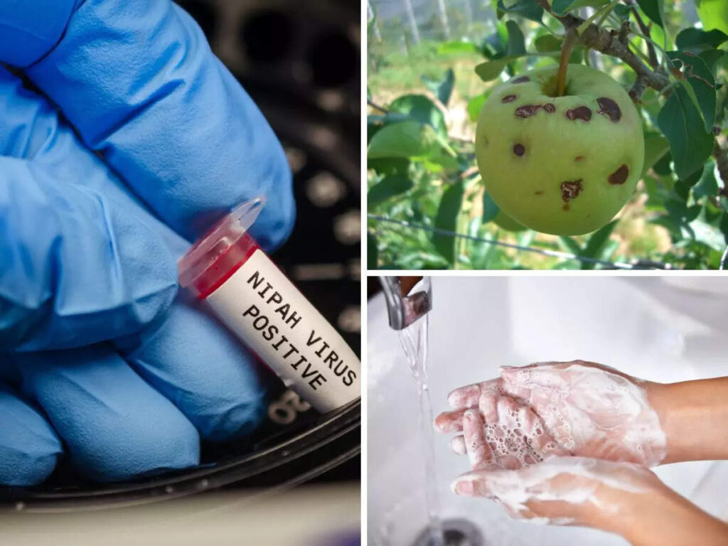 فيروس نيباه