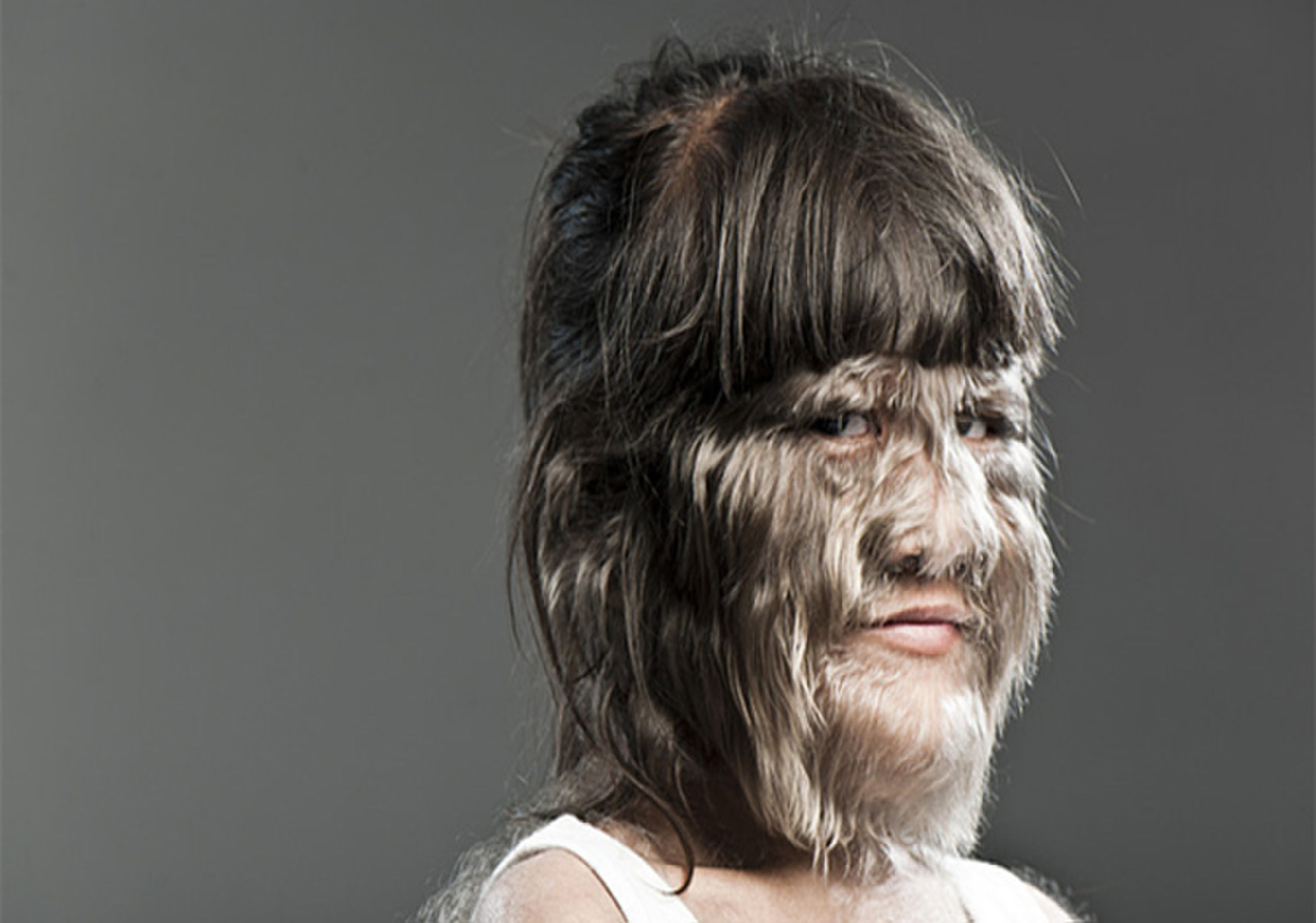 هل تسبب الأطعمة غير التقليدية متلازمة المستذئب