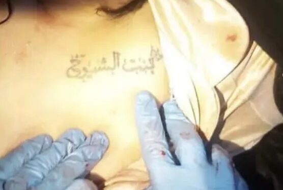 صور أم فهد بالتشريح