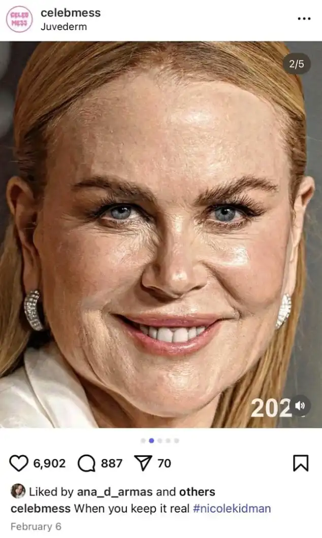 آنا دي أرماس