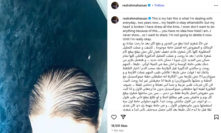 رحمه حسن تكشف أزمة مواجهة الصلع والتحديات الصحية بشجاعة رحمة حسن