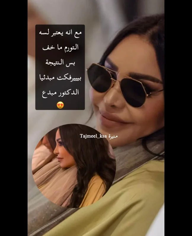 أحلام الشامسي