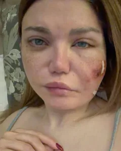 الإعلامية ياسمين الخطيب تمر بوعكة صحية مفاجئة وجراحة عاجلة الإعلامية ياسمين